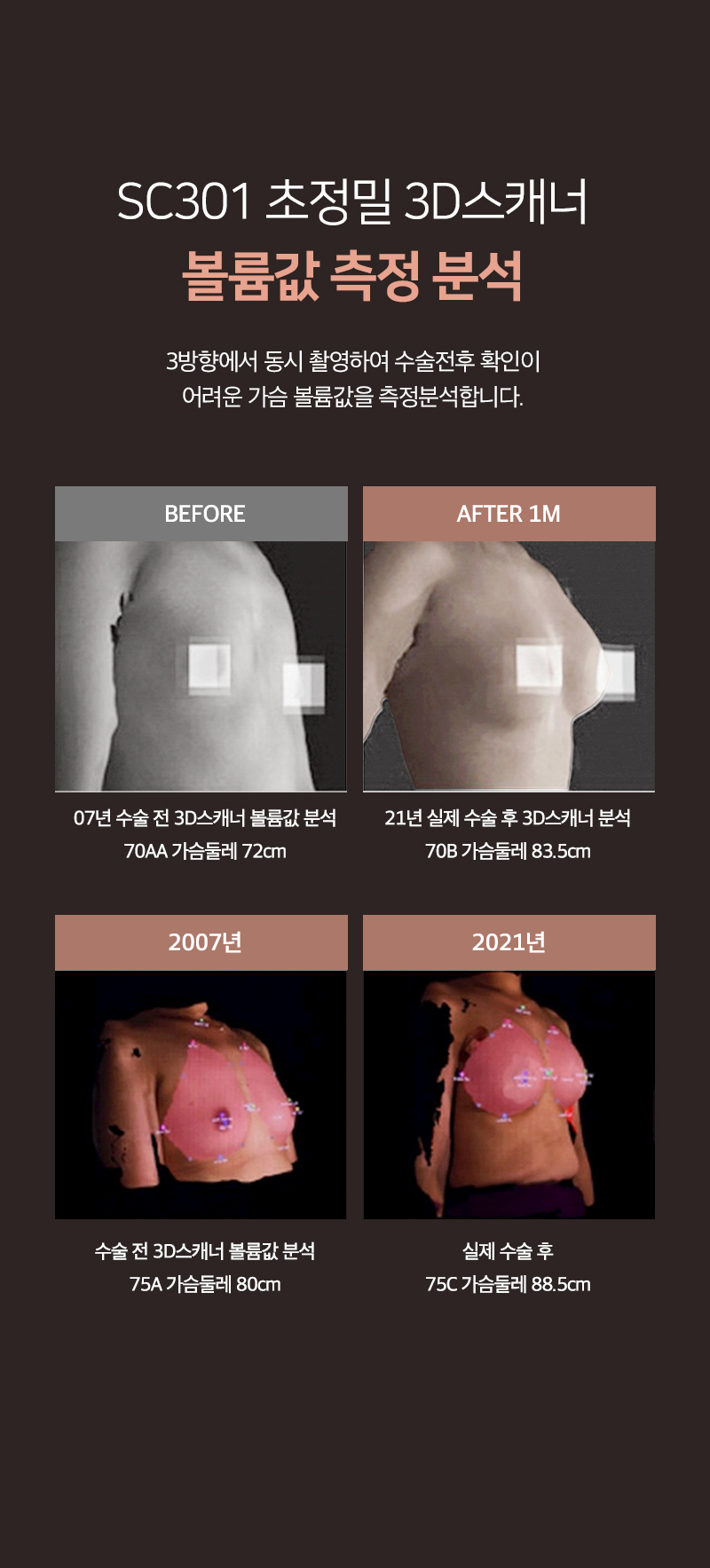 SC301 초정밀 3D스캐너 볼륨값 측정 분석