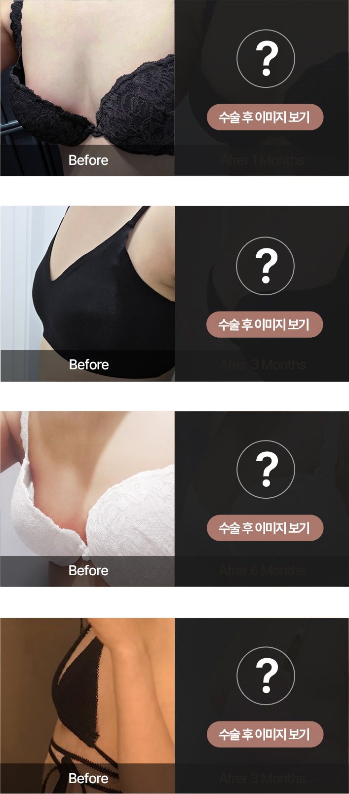수술 후 이미지 보기 - 본인인증 후 확인 가능