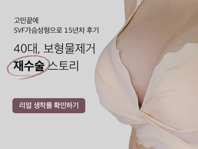 40대, 보형물제거 재수술 스토리 - 리얼 생착률 확인하기