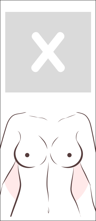 아니오
